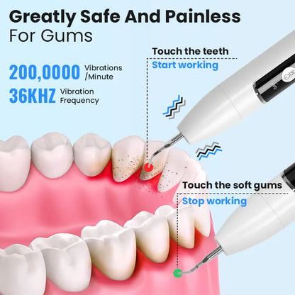 DentiPure – Le soin ultrasonique pour un sourire professionnel