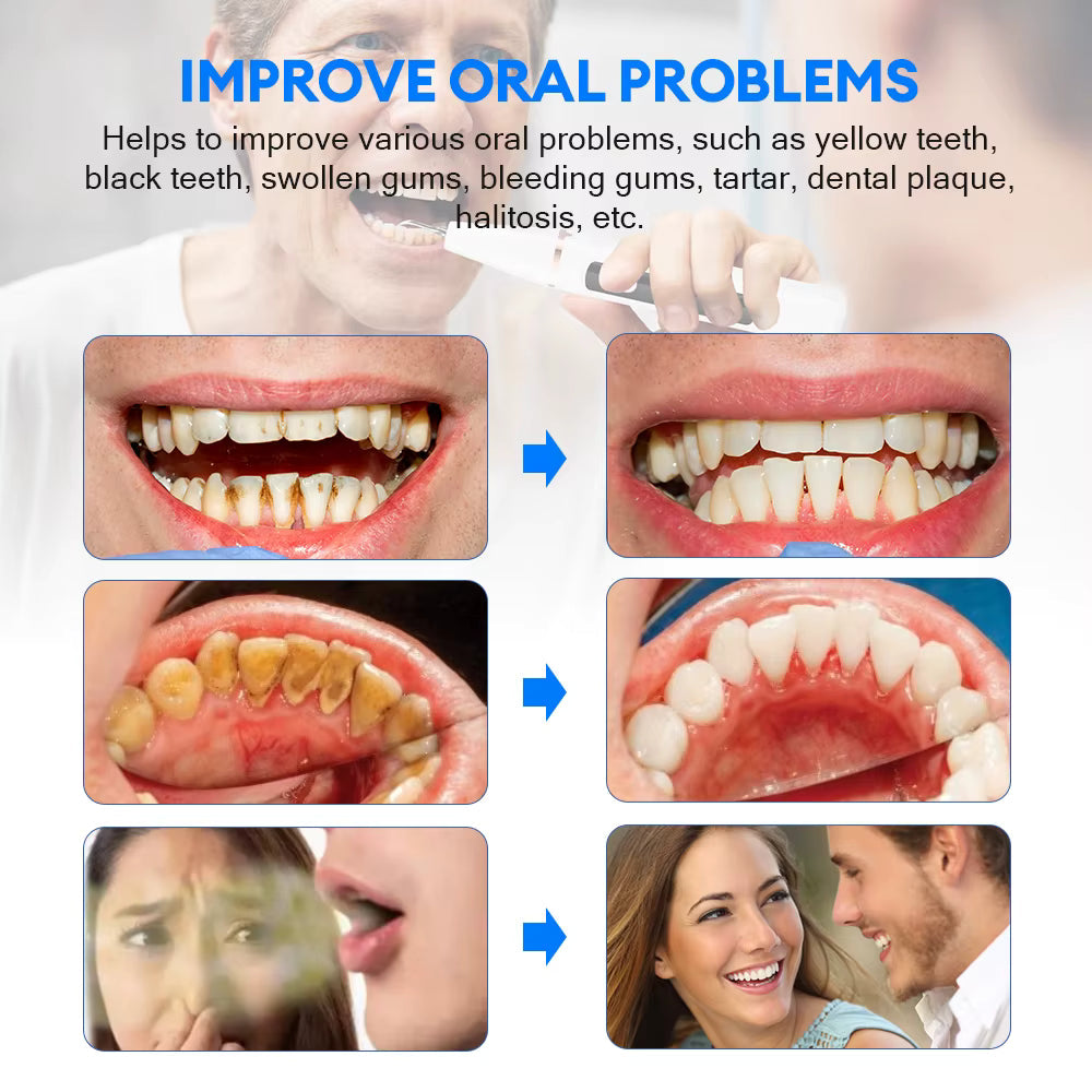 DentiPure – Le soin ultrasonique pour un sourire professionnel