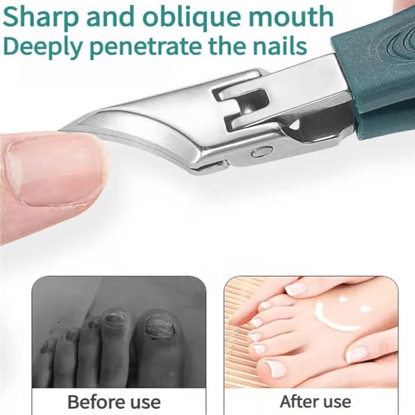 PodAigle – Le kit coupe-ongles de précision pour ongles épais et incarnés