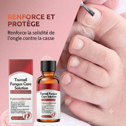 FungiClear 360 – Le traitement antibactérien pour régénérer vos ongles en profondeur