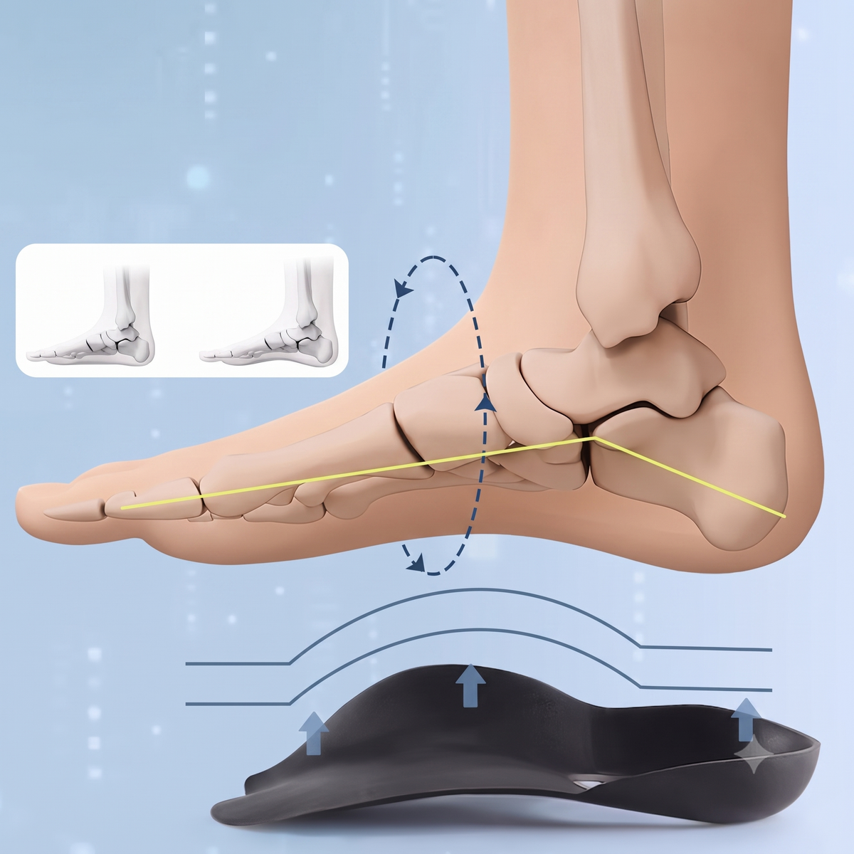 OrthoAlign – Support ergonomique pour corriger les pieds plats