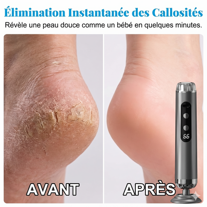 PediSpa Pro 5V – La râpe électrique à 5 vitesses pour des pieds lisses comme en institut