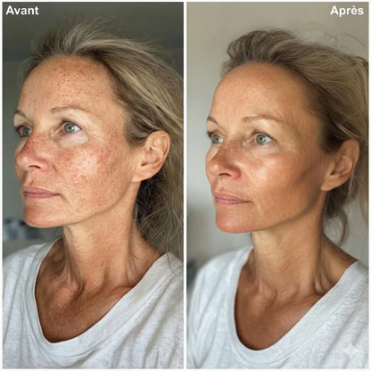 SecondSkin™ – Couvrance invisible et confort absolu