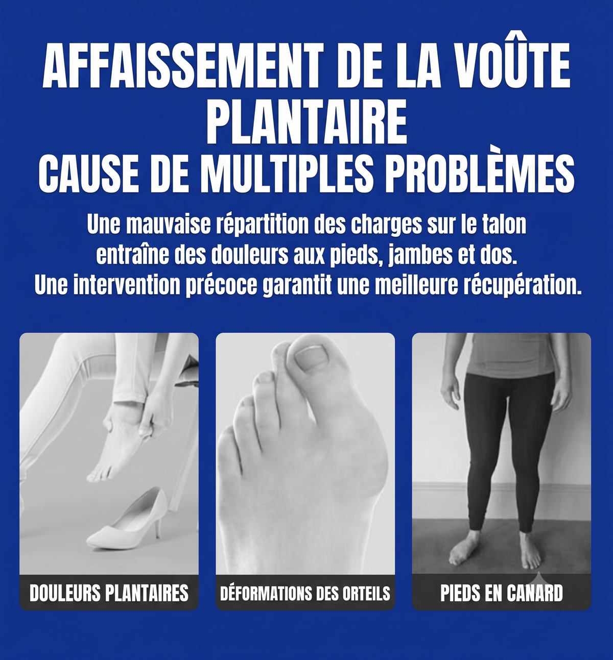 OrthoAlign – Support ergonomique pour corriger les pieds plats