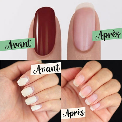 MagicRemove – Retrait facile et rapide de votre vernis semi-permanent ou gel directement depuis la maison