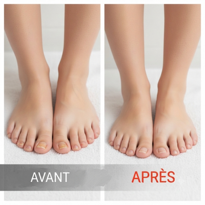 FungiClear 360 – Le traitement antibactérien pour régénérer vos ongles en profondeur