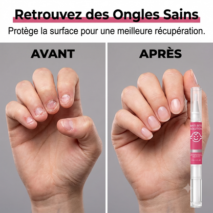 NailGuard – La solution douce et efficace anti-morsure