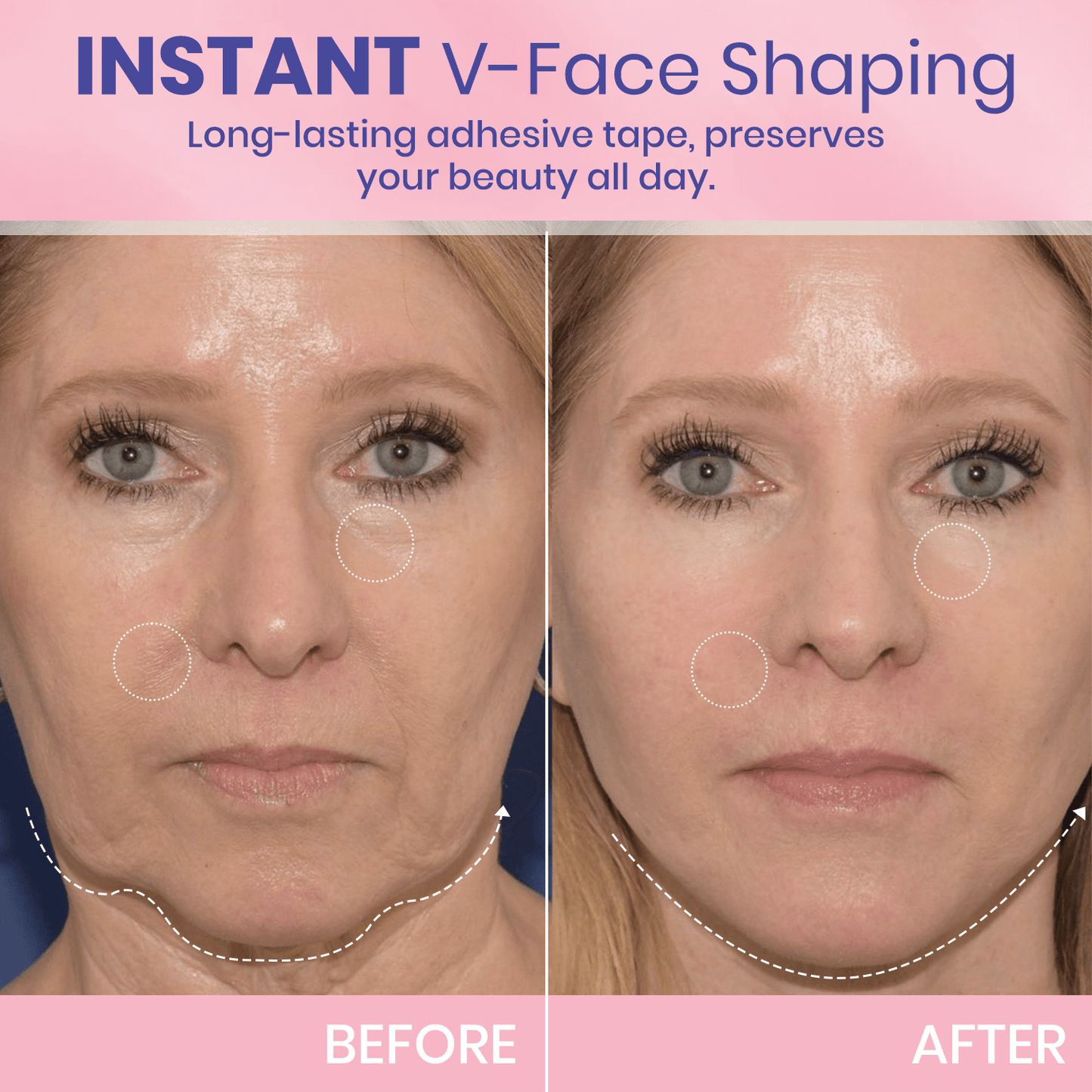 V-Lift Invisible – Le secret d'un visage sculpté en un instant