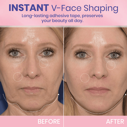 V-Lift Invisible – Le secret d'un visage sculpté en un instant