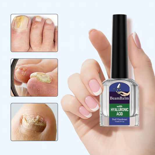 OnychoGuard™ – Soin antifongique et réparation structurelle