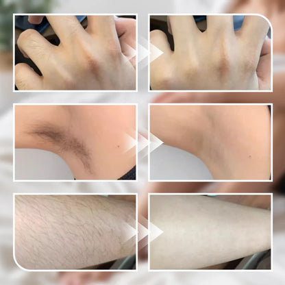 DermaSoft Pro – La formule douce pour hommes et femmes afin d'éliminer les poils sans aucune irritation